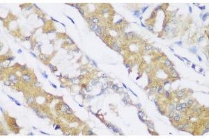 Immunohistochemistry of paraffin-embedded Human stomach using FA2H Polyclonal Antibody at dilution of 1:150 (40x lens). (FA2H anticorps)