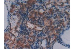 Detection of MPG in Human Thyroid Tissue using Polyclonal Antibody to N-Methylpurine DNA Glycosylase (MPG)