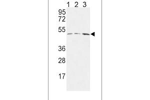HLN1 Antibody (N-term) 9791a western blot analysis in MCF-7(lane 1),Jurkat(lane 2),HepG2(lane 3) cell line lysates (35 μg/lane). (HAPLN1 anticorps  (N-Term))