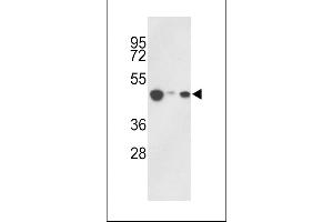 Western blot analysis of hHAT1-E404 in 293, HepG2, Jurkat cell line lysates (35ug/lane) (HAT1 anticorps  (C-Term))