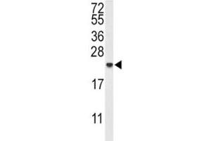 Western blot analysis of IL-10 antibody and MDA-MB435 lysate. (IL-10 anticorps  (AA 27-53))