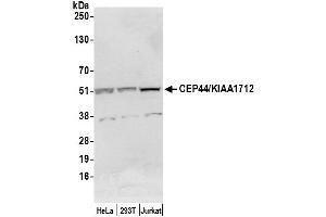 anti-Centrosomal Protein 44kDa (CEP44) (AA 340-390) antibody