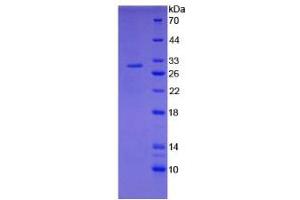 SDS-PAGE analysis of Rat Tissue Factor Protein. (Tissue factor Protéine)