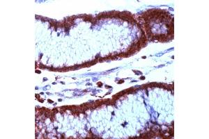 Immunohistochemistry (IHC) image for anti-Baculoviral IAP Repeat-Containing 5 (BIRC5) (N-Term) antibody (ABIN4369171) (Survivin anticorps  (N-Term))