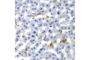 Immunohistochemistry of paraffin-embedded rat liver using NR0B2 antibody (ABIN5970937) at dilution of 1/100 (40x lens). (NR0B2 anticorps)