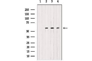 Western blot analysis of extracts from various samples, using OXCT1 antibody. (OXCT1 anticorps  (Internal Region))