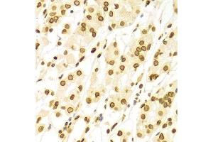 Immunohistochemistry of paraffin-embedded Human gastric using Lamin A/C antibody.