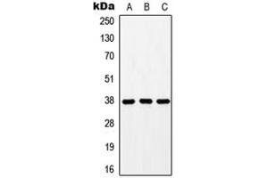 Western blot analysis of GPR171 expression in HEK293T (A), mouse liver (B), rat liver (C) whole cell lysates. (GPR171 anticorps  (Center))