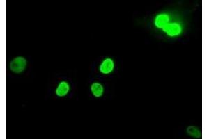 Image no. 2 for anti-MAD2 Mitotic Arrest Deficient-Like 1 (Yeast) (MAD2L1) antibody (ABIN1499249)