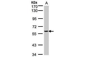 Western Blotting (WB) image for anti-Tyrosyl-tRNA Synthetase (Yars) (AA 357-520) antibody (ABIN467437) (YARS anticorps  (AA 357-520))