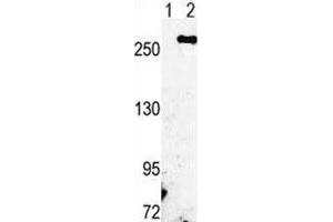 Western blot analysis of FASN antibody and 293 cell lysate either nontransfected (Lane 1) or transiently transfected with the FASN gene (2). (Fatty Acid Synthase anticorps  (AA 942-973))