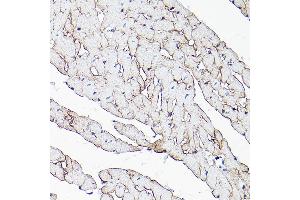 Immunohistochemistry of paraffin-embedded mouse heart using Dystrophin Rabbit pAb (ABIN1679546, ABIN3015473, ABIN3015474 and ABIN6218357) at dilution of 1:25 (40x lens).