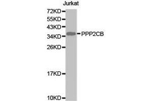 Western Blotting (WB) image for anti-Protein Phosphatase 2, Catalytic Subunit, beta Isozyme (PPP2CB) antibody (ABIN1874224) (PPP2CB anticorps)