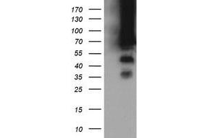 Image no. 8 for anti-tRNA Methyltransferase 2 Homolog A (TRMT2A) antibody (ABIN1501515) (TRMT2A anticorps)