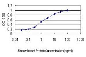 Detection limit for recombinant GST tagged SURB7 is approximately 0. (MED21 anticorps  (AA 1-144))
