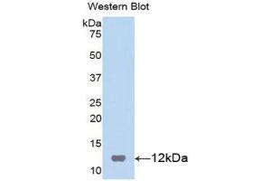 Western Blotting (WB) image for anti-S100 Calcium Binding Protein B (S100B) (AA 1-92) antibody (ABIN1860490) (S100B anticorps  (AA 1-92))