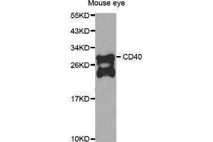 Western Blotting (WB) image for anti-CD40 (CD40) antibody (ABIN6213680) (CD40 anticorps)