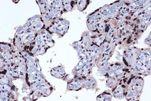 Immunohistochemistry of paraffin-embedded human placenta using JunD Rabbit mAb (ABIN7268051) at dilution of 1:100 (40x lens).