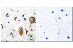 Immunohistochemical analysis of paraffin-embedded human brain tissue using GluR8 antibody (ABIN5976415). (GRM8 anticorps  (C-Term))