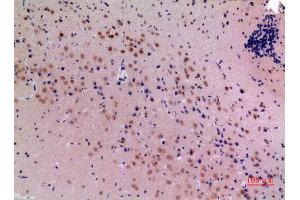 Immunohistochemistry (IHC) analysis of paraffin-embedded Mouse Brain, antibody was diluted at 1:100.