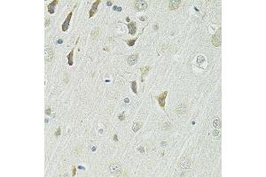 Immunohistochemistry of paraffin-embedded rat brain using SLC1A4 antibody.