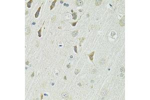 Immunohistochemistry of paraffin-embedded rat brain using SLC1A4 antibody. (SLC1A4 anticorps  (AA 140-220))