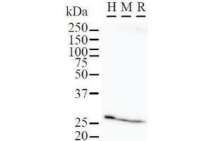 Detection of FBP3 by Western Blot.