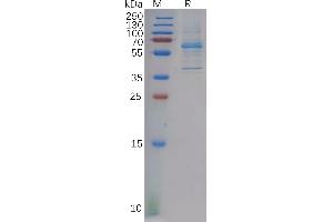 Human Protein, hFc Tag on SDS-PAGE under reducing condition.