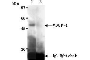 Western Blotting (WB) image for anti-Thioredoxin Interacting Protein (TXNIP) antibody (ABIN567793)