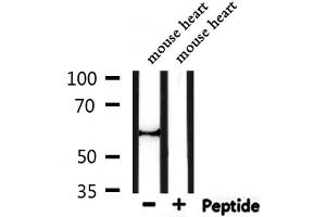 Western blot analysis of extracts from mouse heart, using Perilipin A Antibody. (PLIN1 anticorps  (C-Term))