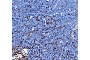 IHC analysis of TCR alpha/TRAC using anti-TCR alpha/TRAC antibody (ABIN6719654). (TRAC anticorps  (AA 1-114))