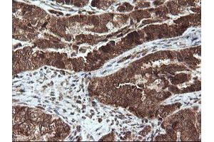 Image no. 3 for anti-serine/threonine Kinase 38 Like (STK38L) (AA 1-281) antibody (ABIN1490699)