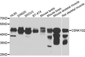 Western blot analysis of extracts of various cell lines, using CSNK1G2 antibody (ABIN4903389) at 1:1000 dilution. (Casein Kinase 1 gamma 2 anticorps)