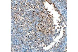 IHC analysis of PCNA using anti-PCNA antibody (ABIN7599179).