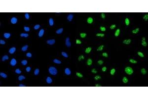 IF analysis of CRTC3 using anti-CRTC3 antibody (ABIN7599779). (CRTC3 anticorps  (AA 116-619))