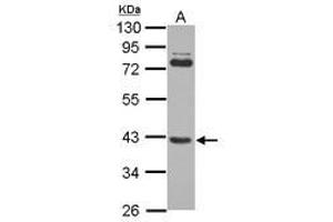 Image no. 2 for anti-SET and MYND Domain Containing 3 (SMYD3) (AA 21-416) antibody (ABIN1501007) (SMYD3 anticorps  (AA 21-416))