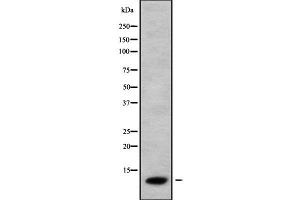 Western blot analysis of CCL26 using COLO205 whole cell lysates (CCL26 anticorps  (Internal Region))