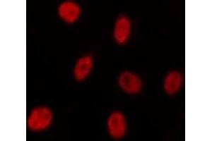 ABIN6275536 staining HepG2 by IF/ICC. (PLK5 anticorps  (Internal Region))