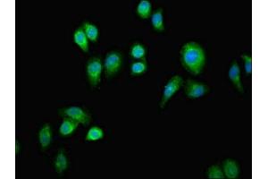 Immunofluorescent analysis of A549 cells using ABIN7154609 at dilution of 1:100 and Alexa Fluor 488-congugated AffiniPure Goat Anti-Rabbit IgG(H+L) (ERAL1 anticorps  (AA 271-382))