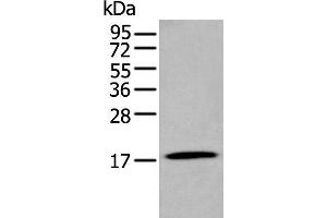 Western blot analysis of Human stomach tissue lysate using GKN2 Polyclonal Antibody at dilution of 1:250 (Gastrokine 2 anticorps)
