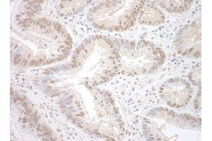 Immunohistochemistry (IHC) image for anti-RNA Binding Motif Protein 17 (RBM17) (AA 25-75) antibody (ABIN7448811) (RBM17 anticorps  (AA 25-75))
