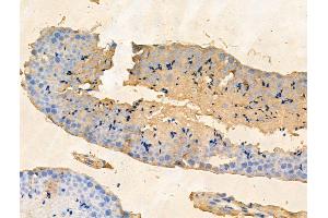 ABIN7094852 and ABIN7098903 at 1/100 staining Mouse testis tissue by IHC-P.
