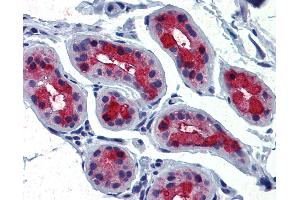 Anti-TSH Receptor antibody IHC of human skin.