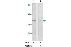 Western blot analysis of extracts from Jurkat cells, treated with PMA (125 ng/ml, 30 mins), using FCGR2B polyclonal antibody . (FCGR2B anticorps  (Ser363))