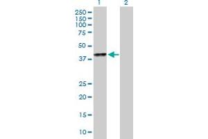 anti-Speckle-Type POZ Protein (SPOP-B) (AA 1-374) antibody