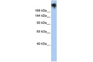 WB Suggested Anti-PKDREJ Antibody Titration:  0. (PKDREJ anticorps  (Middle Region))