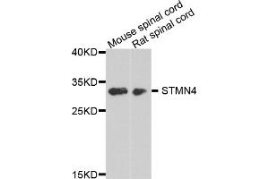 Western blot analysis of extracts of various cell lines, using STMN4 antibody (ABIN5975820) at 1/1000 dilution. (STMN4 anticorps)