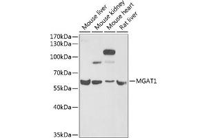 Western blot analysis of extracts of various cell lines, using MG antibody (ABIN6132348, ABIN6143808, ABIN6143810 and ABIN6222011) at 1:1000 dilution. (MGAT1 anticorps  (AA 156-445))
