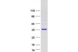 Validation with Western Blot