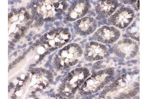 IHC analysis of CRM1 using anti-CRM1 antibody .